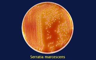 Serratia marcescens